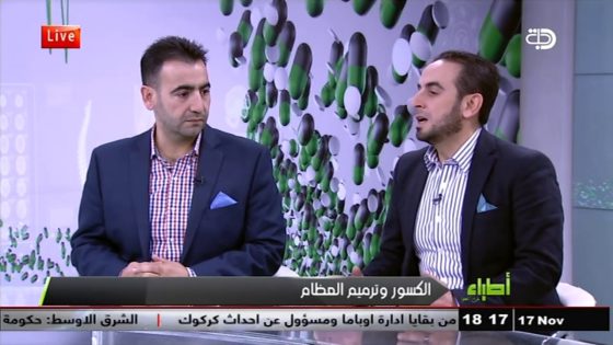 برنامج اطباء على الهواء.. الكسور وترميم العظام 17 11 2017