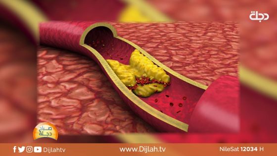 انخفاض الكوليسترول أخطر من ارتفاعه .. تعرف على السبب