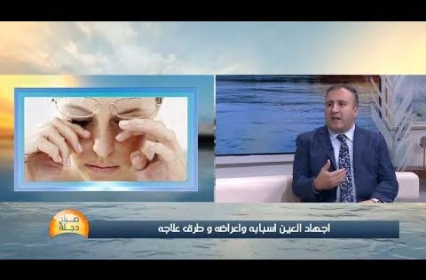 اجهاد العين مع الدكتور فواز المعموري