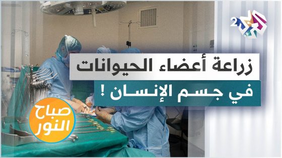زراعة أعضاء الحيوانات في جسم الإنسان .. ماهي التحذيرات؟