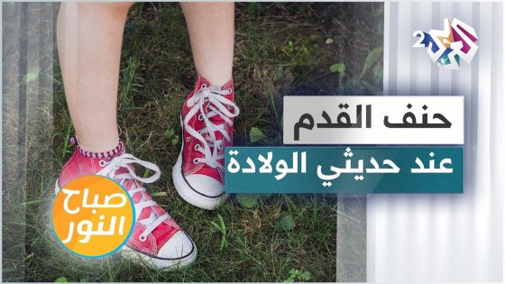 حنف القدم لدى حديثي الولادة .. الأسباب والتشخيص والعلاجات