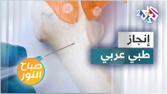 طبيبان لبنانيان يحدثان ثورة في زراعة نقي العظم لمرضى السرطان