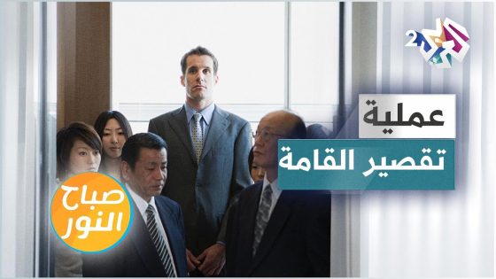 عملية تقصير القامة .. كيف تتمّ؟