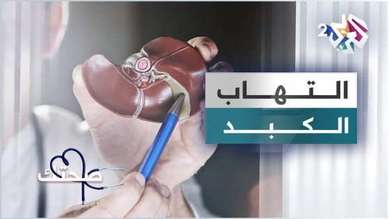 التهاب الكبد .. الأعراض والأسباب وطرق العلاج