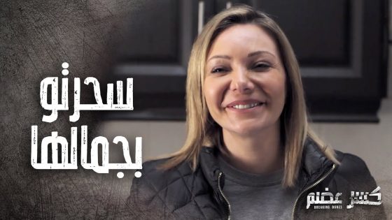 طار عقلو ونسي مرضو بعد ما شاف شمس قدامو ????????- كسر عضم