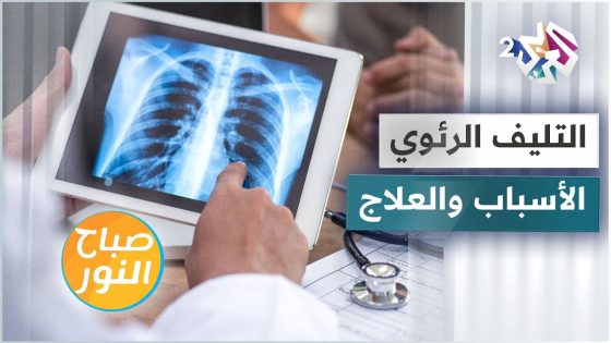 التليف الرئوي .. الأسباب والتشخيص والعلاجات
