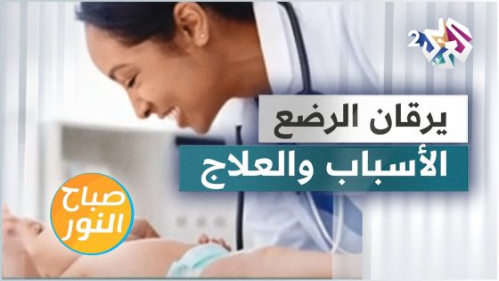 ما هو اليرقان لدى حديثي الولادة؟ وكيف يمكن علاجه؟