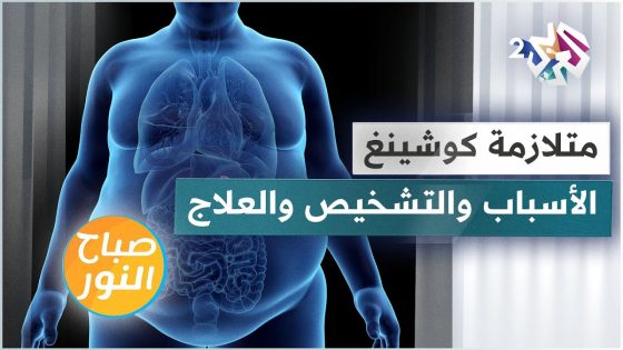متلازمة كوشينغ .. الأسباب والتشخيص وطرق العلاج