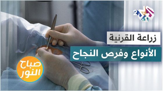 عمليات زراعة القرنية .. أنواعها وفرص نجاحها