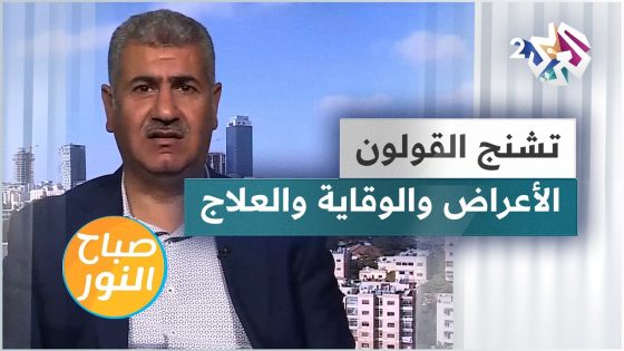 تشنج القولون أو القولون العصبي.. الأعراض والوقاية والعلاج