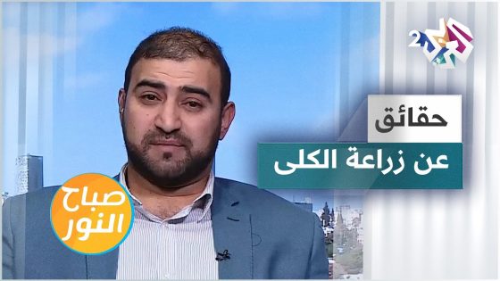 أسئلة وأجوبة حول عملية زراعة الكلى