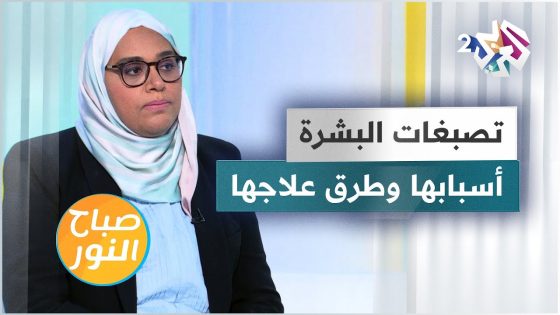 تصبغات البشرة | أسبابها وطرق علاجها