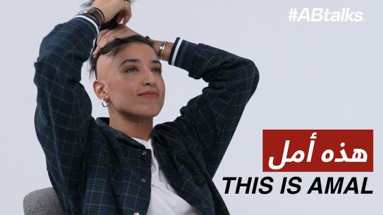 Amal’s Breakthrough with Alopecia – لحظة تحرر أمل من الثعلبة