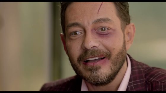 فتحي بدأ يشك في ياسر أخوه وطلب من حماده يخلص على رضوان 😯#البرنس